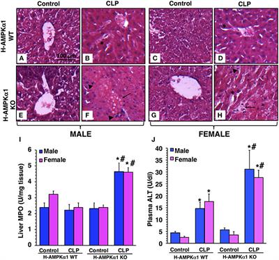 Hepatocyte-Specific Deletion of AMPKα1 Results in Worse Outcomes in Mice Subjected to Sepsis in a Sex-Specific Manner